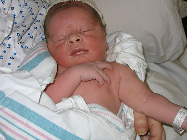 Меконий у новорожденных фото