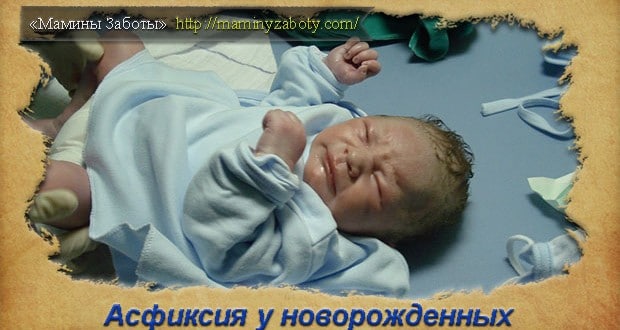 асфиксия у новорожденных