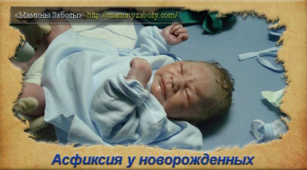 Асфиксия у новорожденных - что это и как лечить