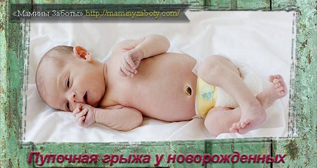 как выглядит пупочная грыжа новорожденного