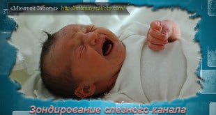 бужирование слезных каналов новорожденного