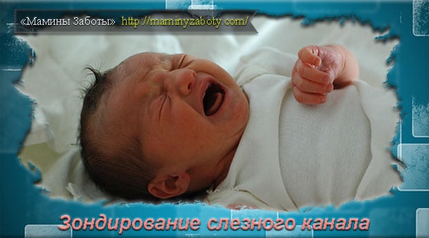 Зондирование слезного канала у новорожденных