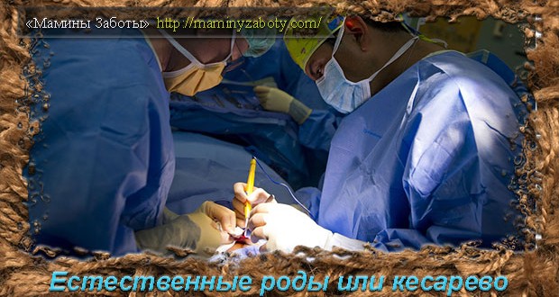 кесарево или естественные роды