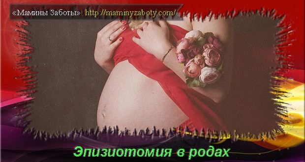 что такое эпизиотомия