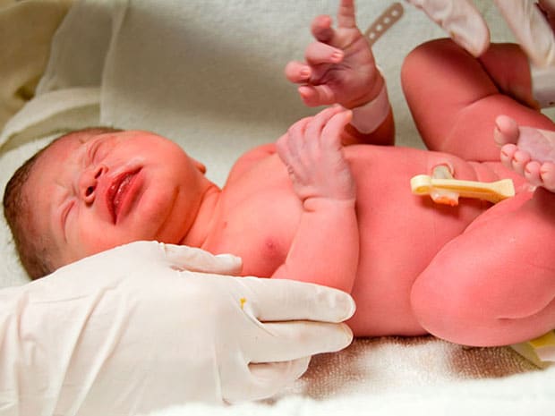 баллы по шкале апгар