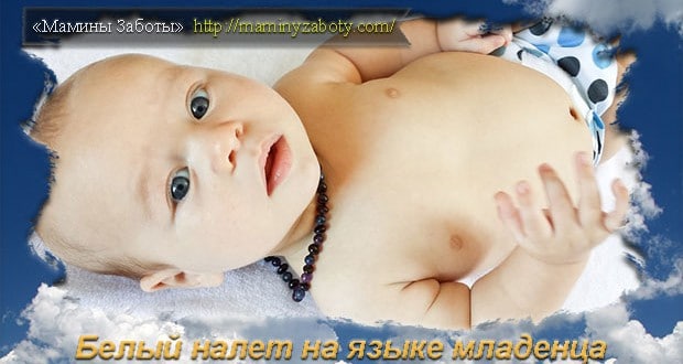 белый налет на языке новорожденного