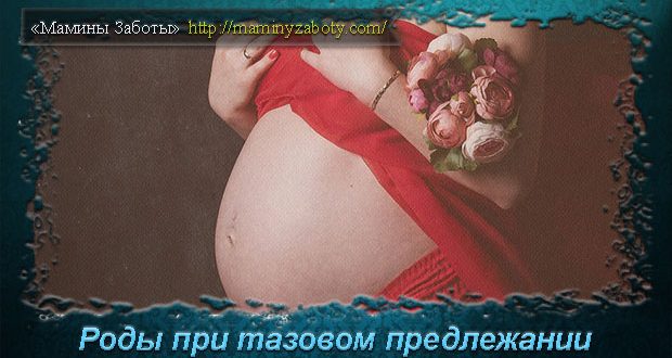 роды в тазовом предлежании