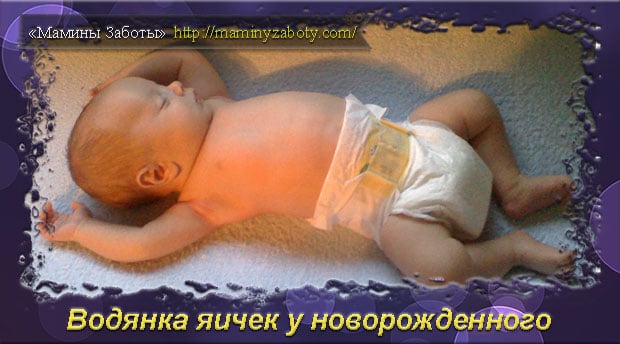 Что такое водянка яичек у новорожденного и как лечить